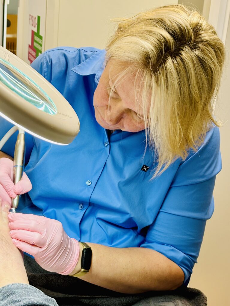 medische pedicure denderleeuw